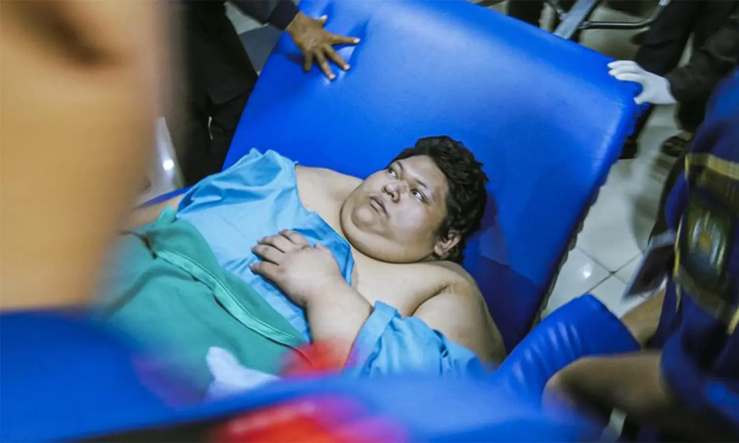 Pria Obesitas Berbobot 300 Kg Meninggal Dunia di RSCM