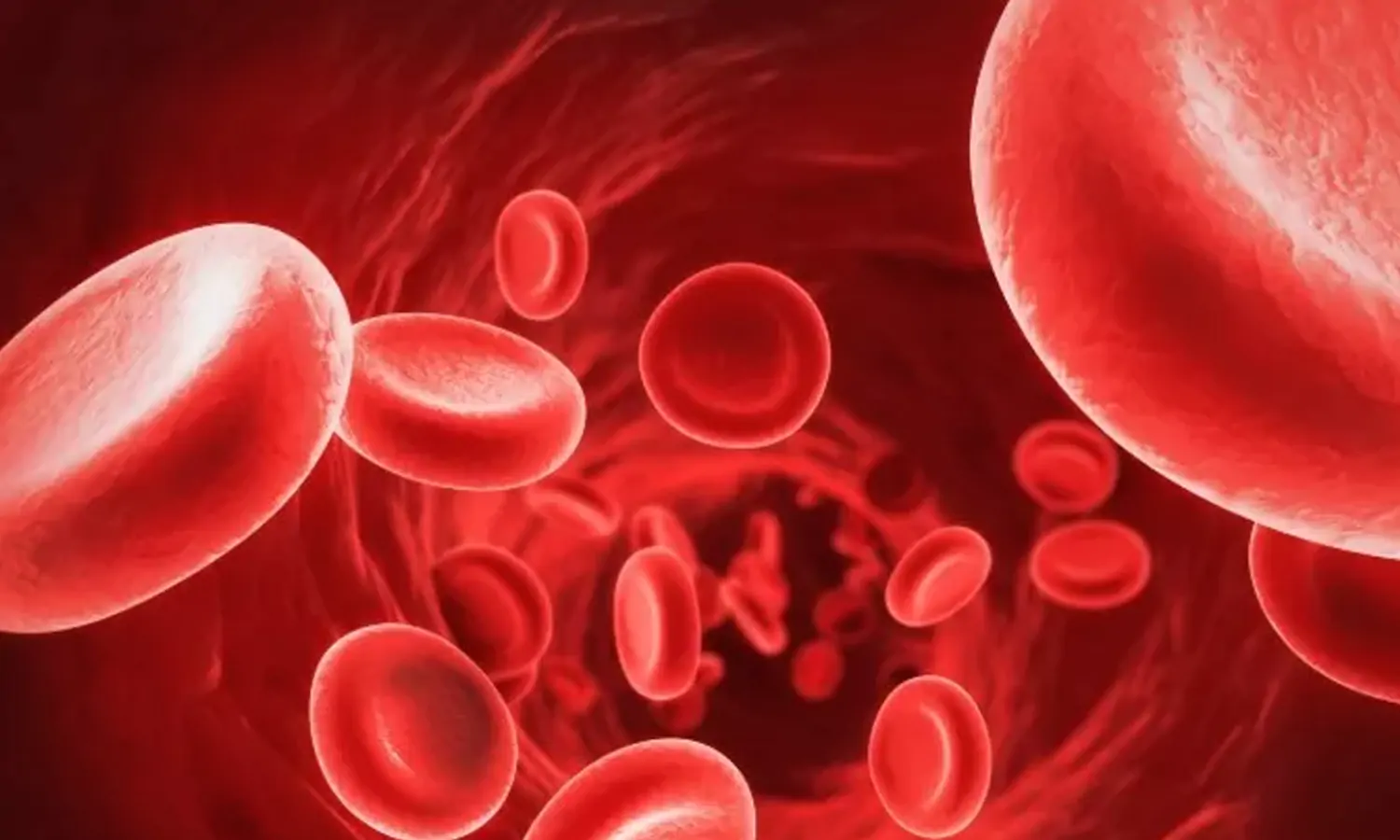 Cara Mencegah Anemia Yang Mudah Dilakukan