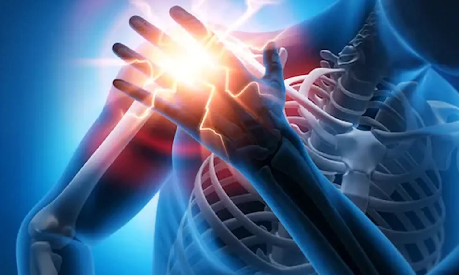 Frozen Shoulder: Gejala, Penyebab, Pengobatan dan Cara Mencegah