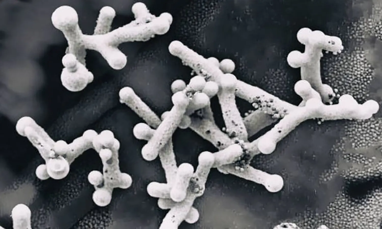 Mengungkap Ancaman Mematikan Infeksi Jamur Candida Auris di Amerika