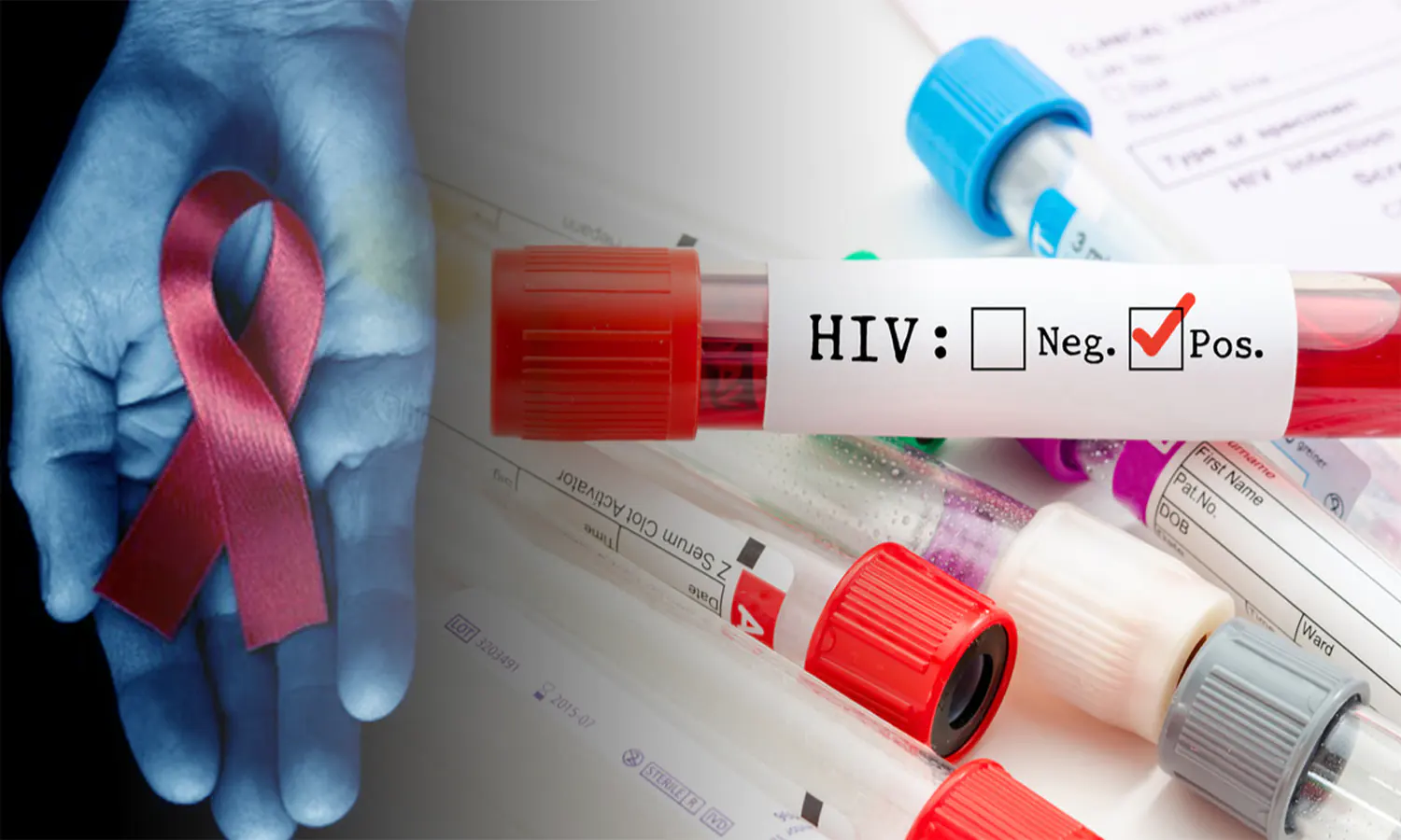 Sebanyak 90 Warga Terdata HIV/AIDS, 5 Meninggal Dunia