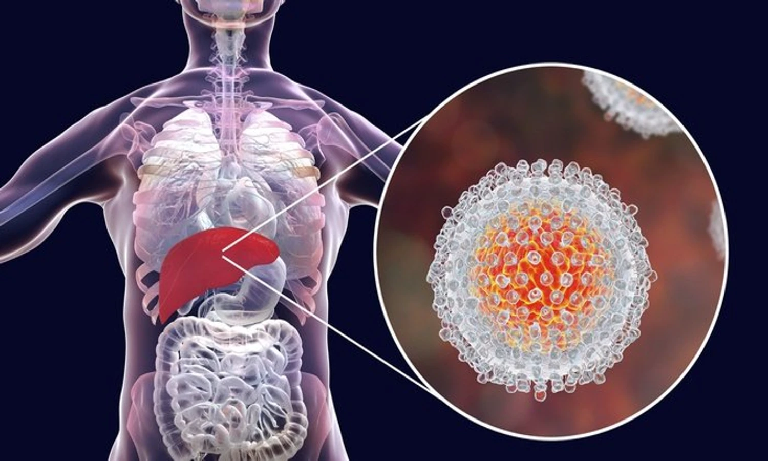 28 Juli Diperingati Sebagai Hari Hepatitis Sedunia: Kenali Jenis dan Perbedaannya