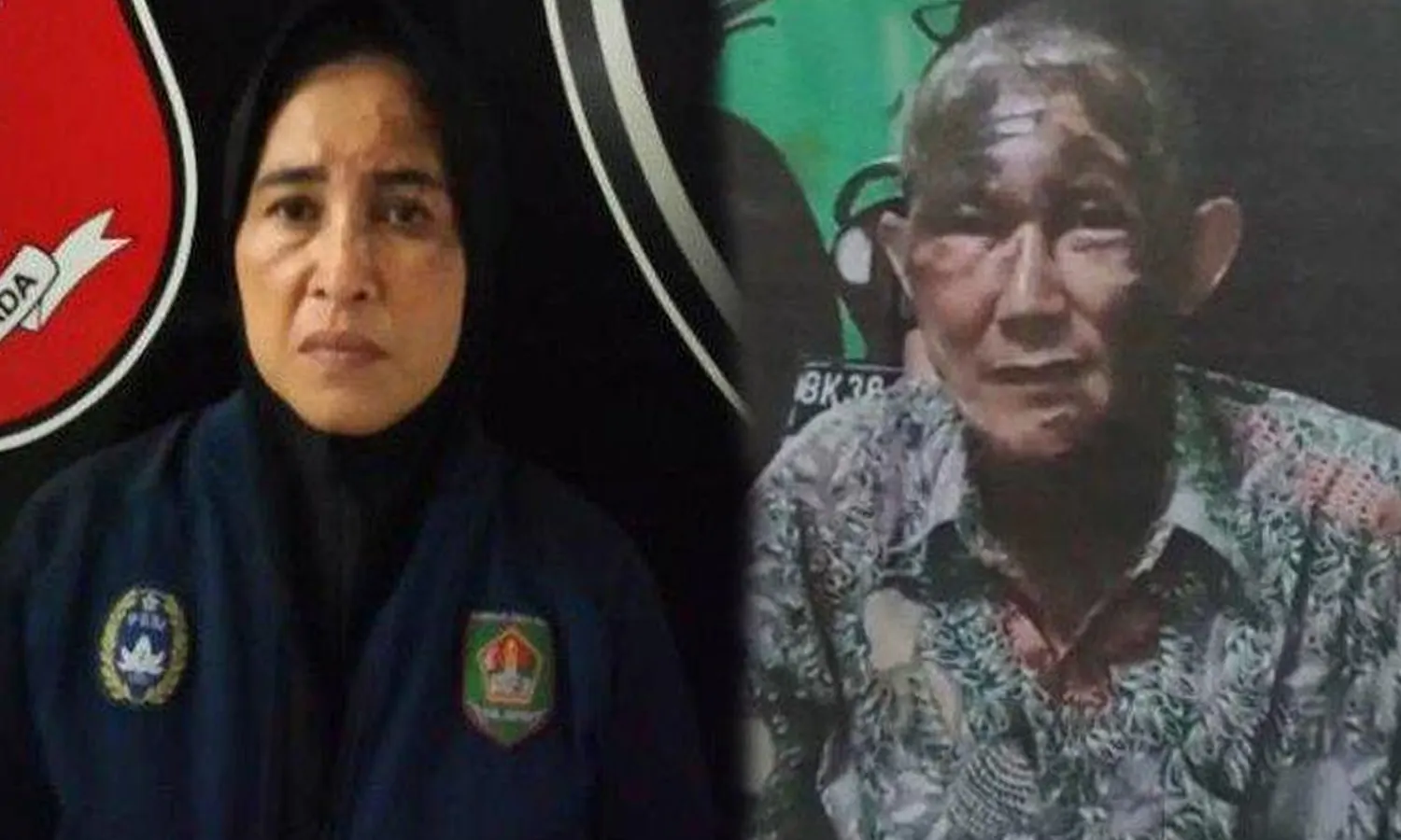 Istri di Asahan Sewa Orang Siram Suami dengan air Keras