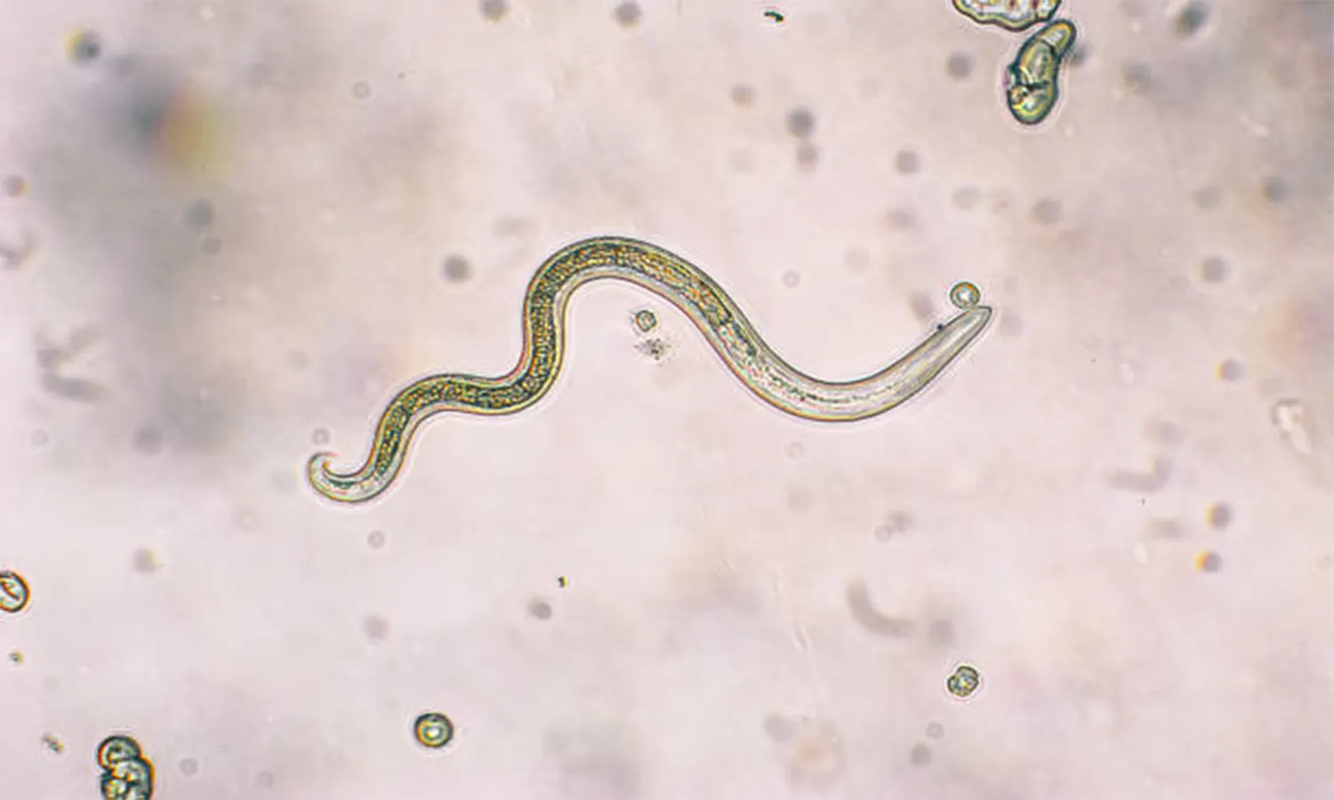 Ciri-Ciri Nematoda, Lengkap dengan Klasifikasi, Struktur, Reproduksi, dan Contoh Hewannya