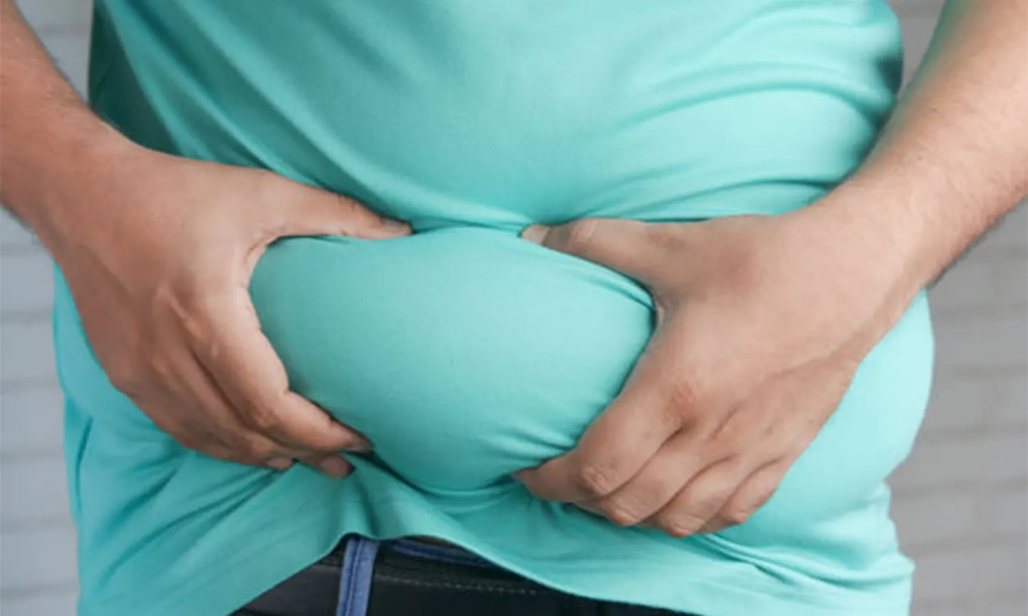 Pria Obesitas 200 Kg Asal Tangerang Meninggal Dunia di RSCM