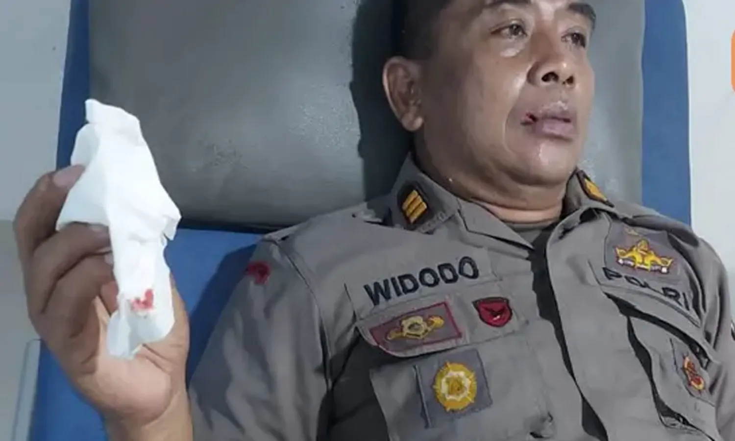 Terkena Lemparan batu saat Ricuh Demo di Makassar, Wakapolsek Dilarikan ke Rumah Sakit