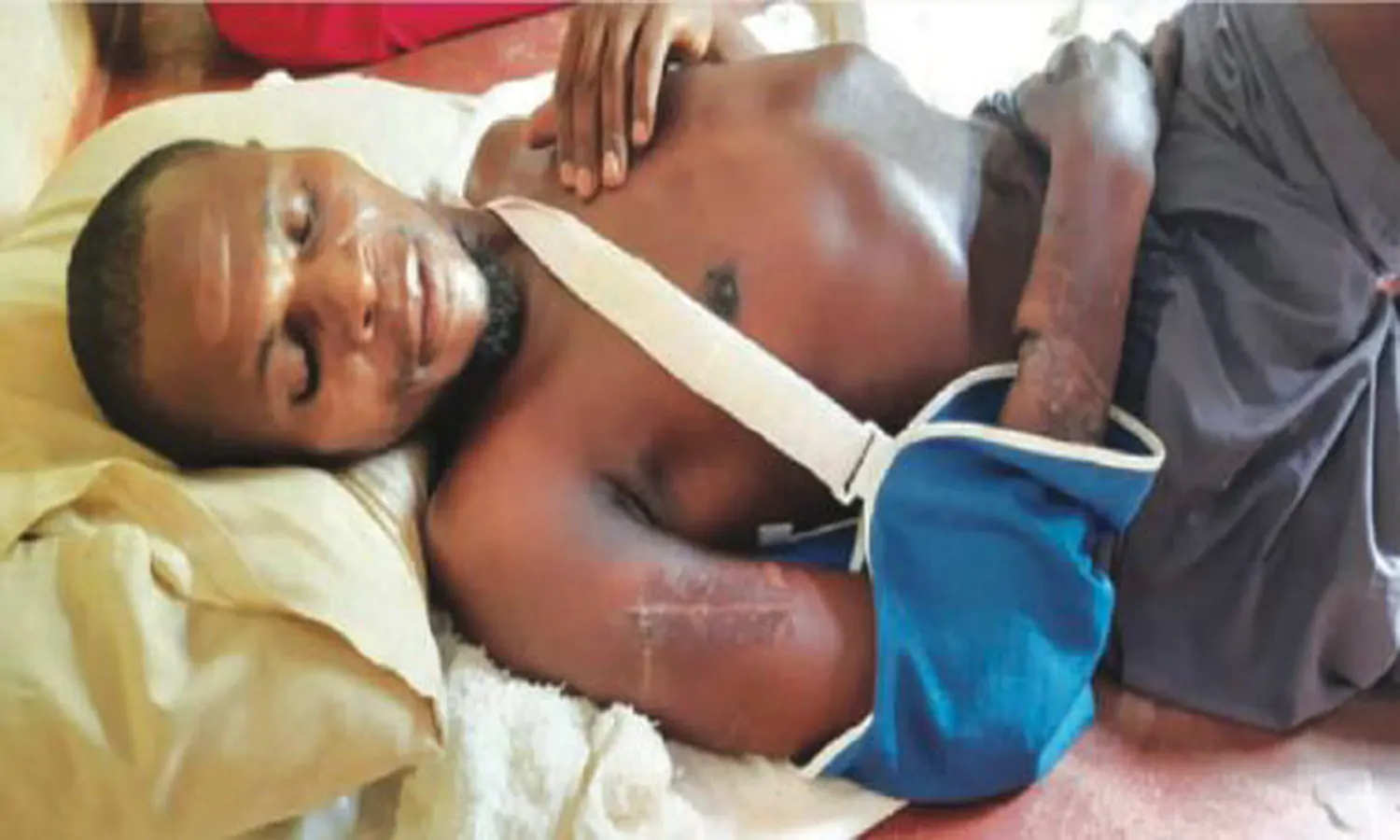 Untung bisa Selamat, Pria Zimbabwe Lolos dari Serangan 3 Buaya Sekaligus