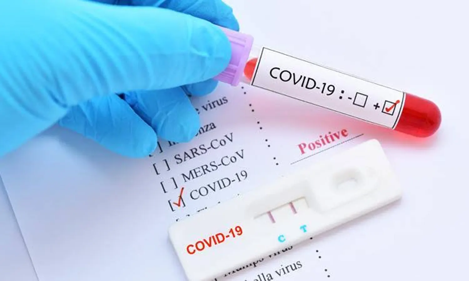 Update Covid-19 per 1 Agustus 2022: Positif Bertambah 3.696 Kasus