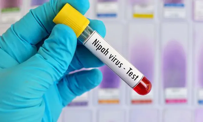 Covid-19 Belum Selesai, Muncul Lagi Virus Nipah di India