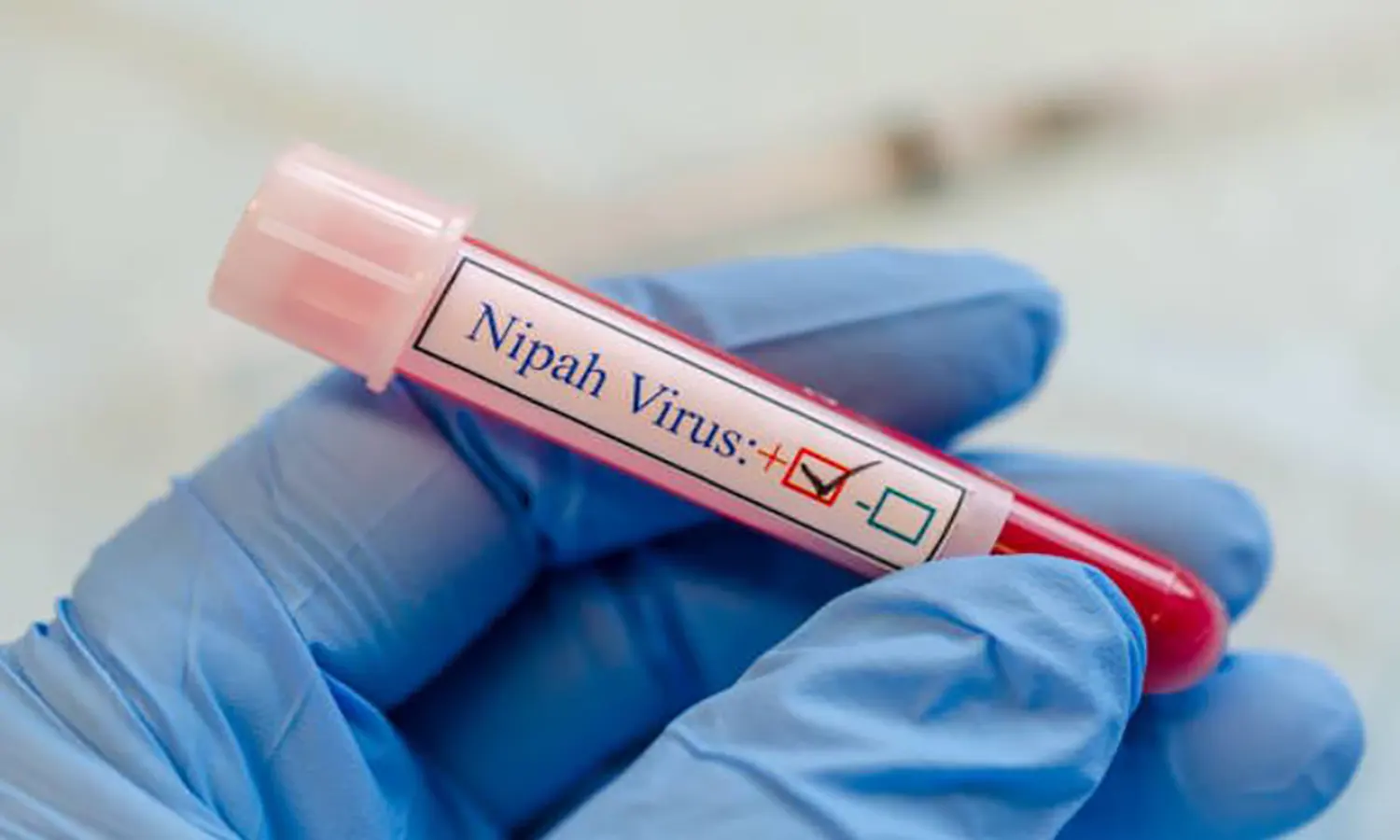 Langkah Pemerintah India Hadapi Wabah Virus Nipah, Pelacakan Kontak Erat hingga Pengujian Massal